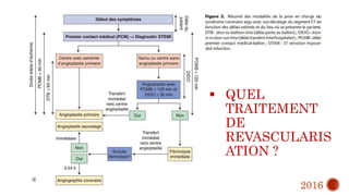  QUEL
TRAITEMENT
DE
REVASCULARIS
ATION ?
2016
 