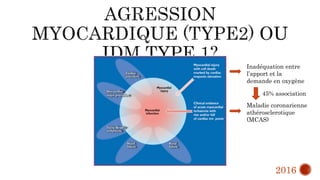 Inadéquation entre
l’apport et la
demande en oxygène
Maladie coronarienne
athérosclerotique
(MCAS)
45% association
2016
 