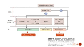 NSTEM
I
Infarctus Type 2
2016
 