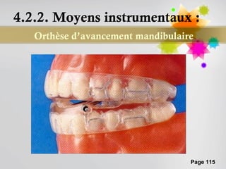 4.2.2. Moyens instrumentaux :
   Orthèse d’avancement mandibulaire




                                   Page 115
 