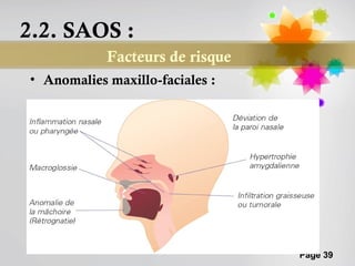 2.2. SAOS :
            Facteurs de risque
• Anomalies maxillo-faciales :




                                 Page 39
 