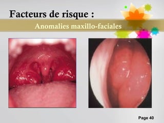 Facteurs de risque :
     Anomalies maxillo-faciales




                                  Page 40
 
