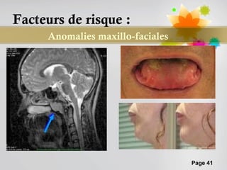 Facteurs de risque :
     Anomalies maxillo-faciales




                                  Page 41
 
