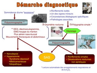 Démarche diagnostique Somnolence diurne " excessive " Dépistage     Narcolepsie     Hypersomnie  Syndrome dépressif Médicamenteuse  Idiopathique   Ronflements isolés  Un des signes mineurs  Circonstances étiologiques spécifiques  Pathologies associées    Polygraphie simple *    Oxymétrie nocturne Polysomnographie ** * Lecture automatisée des enregistrements respiratoires et de la S a O 2 Polysomnographie     Ronflements simples    Désaturations nocturnes non apnéiques SAS ** EEG, électrooculogramme, EMG houppe du menton Flux aérien naso-buccal Mouvements thoraciques et abdominaux 