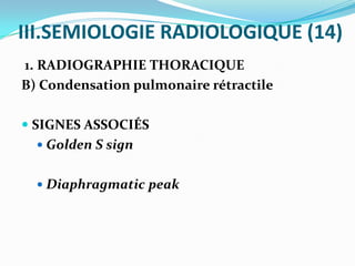 Sign Rectractiles Syndrome de condensation pulmonaire | PPTX