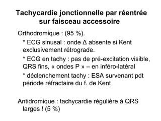 Tachycardie jonctionnelle par réentrée
sur faisceau accessoire
Orthodromique : (95 %).
* ECG sinusal : onde Δ absente si Kent
exclusivement rétrograde.
* ECG en tachy : pas de pré-excitation visible,
QRS fins, « ondes P » – en inféro-latéral
* déclenchement tachy : ESA survenant pdt
période réfractaire du f. de Kent
Antidromique : tachycardie régulière à QRS
larges ! (5 %)
 