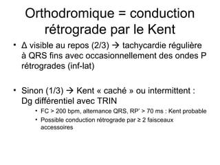 Orthodromique = conduction
rétrograde par le Kent
• Δ visible au repos (2/3)  tachycardie régulière
à QRS fins avec occasionnellement des ondes P
rétrogrades (inf-lat)
• Sinon (1/3)  Kent « caché » ou intermittent :
Dg différentiel avec TRIN
• FC > 200 bpm, alternance QRS, RP’ > 70 ms : Kent probable
• Possible conduction rétrograde par ≥ 2 faisceaux
accessoires
 