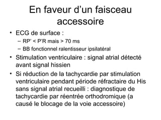 En faveur d’un faisceau
accessoire
• ECG de surface :
– RP’ < P’R mais > 70 ms
– BB fonctionnel ralentisseur ipsilatéral
• Stimulation ventriculaire : signal atrial détecté
avant signal hissien
• Si réduction de la tachycardie par stimulation
ventriculaire pendant période réfractaire du His
sans signal atrial recueilli : diagnostique de
tachycardie par réentrée orthodromique (a
causé le blocage de la voie accessoire)
 