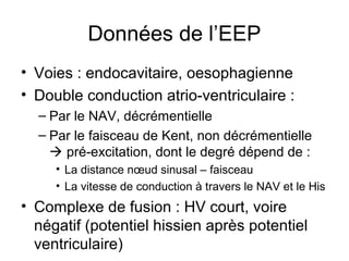 Données de l’EEP
• Voies : endocavitaire, oesophagienne
• Double conduction atrio-ventriculaire :
– Par le NAV, décrémentielle
– Par le faisceau de Kent, non décrémentielle
 pré-excitation, dont le degré dépend de :
• La distance nœud sinusal – faisceau
• La vitesse de conduction à travers le NAV et le His
• Complexe de fusion : HV court, voire
négatif (potentiel hissien après potentiel
ventriculaire)
 