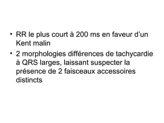 • RR le plus court à 200 ms en faveur d’un
Kent malin
• 2 morphologies différences de tachycardie
à QRS larges, laissant suspecter la
présence de 2 faisceaux accessoires
distincts
 