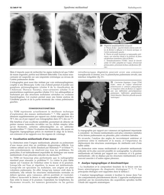 32-360-P-10 Syndrome médiastinal Radiodiagnostic 
*A *B 
Mais il importe aussi de rechercher les signes indirects tel que l’effet 
de masse engendré, parfois seul élément détectable. Une masse sous-carinaire 
est suspectée sur une empreinte extrinsèque au niveau de 
l’artère pulmonaire droite. 
L’échographie peut aussi être réalisée par voie endooesophagienne, 
couplée à une fibroscopie. Cette voie d’abord permet d’accéder aux 
ganglions périoesophagiens (chaîne 8 de la classification de 
l’American Thoracic Society), sous-carinaires (chaîne 7) et 
paratrachéaux-supérieurs gauches (chaîne 2 G). Les adénopathies se 
traduisent par des structures nodulaires arrondies ou ovalaires 
hypoéchogènes. Cet examen permet aussi une bonne analyse de 
l’oreillette gauche et de la partie terminale des veines pulmonaires 
gauches. 
TOMODENSITOMÉTRIE 
La TDM représente actuellement la meilleure technique 
d’exploration des masses médiastinales [2, 3]. Elle apporte des 
éléments supplémentaires par rapport aux clichés simples dans 44 à 
78 % des cas et par rapport aux tomographies dans 23 % des cas [57]. 
Elle bénéficie d’une excellente sensibilité, permettant de détecter de 
petites masses tumorales invisibles sur les clichés simples telles 
qu’un thymome, certaines adénomégalies ou un adénome 
parathyroïdien [41]. Outre l’évaluation des dimensions, elle assure un 
diagnostic topographique précis en montrant le siège de la lésion, 
son extension et les rapports avec les organes de voisinage. 
¦ Localisation médiastinale d’une masse 
La distinction entre l’origine médiastinale, pleurale ou pulmonaire 
d’une masse peut être un problème diagnostique difficile. Les 
critères utilisés sur le cliché standard par Heitzman [28] et Felson [12], 
cités précédemment, ne résolvent pas tous les problèmes. En 
particulier, il est habituellement impossible de distinguer une masse 
médiastinale d’une pleurésie enkystée du médiastin [28]. 
La TDM est beaucoup plus performante que la radiographie 
standard pour résoudre ce problème [66]. Le critère le plus fiable 
repose sur l’analyse de l’interface entre la masse et le poumon. 
Lorsqu’elle est lisse et régulière, la masse est médiastinale. 
Lorsqu’elle est spiculaire ou nodulaire, son origine est plus 
volontiers pulmonaire. En effet, lorsqu’une tumeur croît dans le 
médiastin, elle refoule les structures médiastinales normales en 
dehors (graisse, gros vaisseaux, plèvre pariétale et viscérale). 
Celles-ci recouvrent la lésion et sont responsables d’une interface 
lisse entre la masse et le poumon. Cependant, les lymphomes, les 
thymomes invasifs, les tumeurs germinales ou les goitres 
20 Thymome lymphoépithélial encapsulé. 
*C 
A. Thorax de face : opacité à limite externe nette (tê-tes 
de flèches) n’effaçant ni le bouton aortique, ni 
l’artère pulmonaire gauche. 
B. Thorax de profil montrant sa topographie anté-rieure, 
son caractère lobulé et la présence de fines 
calcifications lamellaires (tête de flèche). 
C. Tomodensitométrie (TDM) : masse de densité 
solide (53 UH), polylobée de l’espace rétrosternal 
prévasculaire, présentant de fines calcifications (flè-che). 
intrathoraciques dégénérés peuvent avoir une extension 
transpleurale et donner, avec le parenchyme pulmonaire envahi, une 
interface irrégulière (fig 21). 
21 Carcinome thymique. Coupe TDM 
axiale : masse de l’espace rétrosternal 
préaorticocave à contours polycycliques 
et irréguliers (têtes de flèches) en rapport 
avec une infiltration parenchymateuse 
pulmonaire. Infiltration ganglionnaire 
(étoile blanche). Réaction pleurale associée 
(astérisque). 
La topographie par rapport aux vaisseaux est également importante 
à considérer : les lésions médiastinales sont plus volontiers médiales 
et les lésions pulmonaires ou pleurales, plus volontiers latérales. 
En revanche, l’analyse des angles de raccordement antérieur et 
postérieur entre le médiastin et la masse, et l’importance du 
déplacement des structures anatomiques du médiastin sont d’une 
faible utilité. 
La distinction entre masse médiastinale et pleurésie médiastinale 
enkystée est le plus souvent possible en scanographie. La pleurésie 
médiastinale est latérale par rapport aux vaisseaux et à la graisse 
médiastinale ; elle ne déplace pas les structures médiastinales et est 
souvent associée à d’autres signes pleuraux. 
¦ Analyse topographique et densitométrique 
– La localisation et la composition tissulaire de la lésion sont les 
bases sémiologiques du diagnostic étiologique [38, 56, 59]. Les 
principales étiologies sont rapportées dans le tableau I. 
– L’analyse topographique consiste à localiser la masse dans l’un 
des compartiments précédemment décrits. L’approche multiplanaire 
autorisée par les reconstructions des acquisitions spiralées facilite 
l’étude des rapports anatomiques. 
10 
 