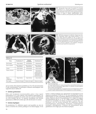 32-360-P-10 Syndrome médiastinal Radiodiagnostic 
qu’au scanner. Des séquences pondérées en T1 et T2 sont nécessaires 
à cette caractérisation. Les principaux éléments sémiologiques sont 
rapportés dans le tableau II. 
¦ Lésions graisseuses 
Elles sont facilement reconnaissables grâce à leur signal 
hyperintense en T1, qui s’atténue, mais demeure hyperintense, sur 
les séquences pondérées T2 comme celui de la graisse médiastinale 
ou sous-cutanée (fig 30). La gamme étiologique des lésions 
graisseuses en IRM est la même que celle décrite pour le scanner. 
¦ Lésions kystiques 
En pondération T1, différents aspects sont possibles au sein du 
kyste, en fonction du contenu protéique et/ou hémorragique. Si les 
29 Méningocèle. Coupe axiale (A) pondérée T1 et frontale 
(B) pondérée en T1 : structure hypo-intense communiquant 
avec les espaces sous-arachnoïdiens par le trou de conjugaison 
droit de T2 (étoile). Cette masse est très hyperintense en pon-dération 
T2 comme le liquide céphalorachidien (LCR). 
La moelle est visible au sein du fourreau dural (tête de flèche). 
*A *B 
kystes à contenu hydrique pur apparaissent en hyposignal sur les 
séquences pondérées T1 (fig 29, 31, 32), ceux présentant un contenu 
hémorragique ou riche en protéines affichent un hypersignal sur les 
mêmes séquences (fig 33). En pondération T2, le signal est toujours 
très hyperintense (fig 29, 31, 32, 33). L’IRM, comme l’examen TDM, 
permet de reconnaître les lésions kystiques à parois fines qui 
orientent vers les kystes primitifs du médiastin (kystes 
bronchogéniques, péricardiques, thymiques, lymphangiomes 
kystiques, méningocèles). L’absence de rehaussement après 
gadolinium est de règle pour des lésions kystiques. 
*A 
*B 
30 Infiltration graisseuse du médiastin. Imagerie par réso-nance 
magnétique (IRM) coupe frontale pondérée T1 (A). 
Coupe axiale transverse pondérée T2 (B). Le signal de la 
graisse est identique à celui de la graisse pariétale thoracique, 
hyperintense en pondération T1 et s’atténuant en pondération 
T2. Aucune déformation des structures vasculaires n’est no-tée. 
Les structures digestives sous-cardiaques témoignent 
d’une hernie par la fente de Larrey associée. 
*A 
*B 
Tableau II. 
Tissu Pondération T1 Densité 
de protons Pondération T2 
Kyste simple Hypo-intense Intermédiaire Hyperintense 
Kyste complexe Hypo-intense ou 
hyperintense 
Hypo-intense ou 
hyperintense 
Hypo-intense ou 
hyperintense 
Graisse Hypo-intense Intermédiaire Hypo-intense 
Tumeur charmes Hypo-intense Intermédiaire Intermédiaire 
Hyperintense 
(lésion focale très 
hyperintense cor-respondant 
à des 
foyers de nécrose) 
Fibrose Hypo-intense Hypo-intense Hypo-intense 
collagénique 
Flux rapide Absence de signal Absence de signal Absence de signal 
31 Kyste bronchogénique. 
A. Coupe axiale pondérée T1 : masse de la gouttière costovertébrale (étoile) à paroi 
fine et de contenu spontanément hypo-intense. Ce caractère est moins fréquent 
dans les kystes bronchogéniques. 
B. Coupe coronale pondérée T2 : le signal de la masse est très hyperintense (étoile) 
comme le liquide céphalorachidien (LCR) témoignant de sa nature kystique. 
14 
 