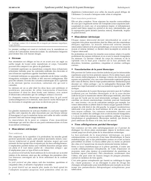 Syndrome pariétal imagerie de la paroi thoracique