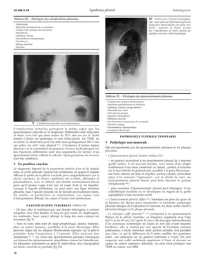 32-520-A-10 Syndrome pleural Radiodiagnostic 
d’emphysème remplies partagent le même signe que les 
épanchements enkystés et le diagnostic différentiel entre empyème 
et abcès n’est fait que dans moins de 50 % des cas sur le cliché 
simple (l’abcès est sphérique et non lenticulaire). En TDM, en 
revanche, la distinction peut être faite dans pratiquement 100 % des 
cas grâce au split sign pleural [53]. L’existence d’autres signes 
pleuraux ou la constatation de plusieurs niveaux hydroaériques sur 
des hauteurs différentes sont des arguments en faveur d’un 
épanchement mixte collecté et enkysté. Après ponctions, les niveaux 
sont très nombreux. 
¦ En position couchée 
Le diagnostic dépend de la proportion relative d’air et de liquide 
dans la cavité pleurale. Quand l’air prédomine ou quand le liquide 
affleure la partie de la plèvre viscérale prise tangentiellement par le 
rayon incident, le liseré capillaire est visible, affirmant le 
pneumothorax, avec, en dehors, une densité anormalement élevée 
pour qu’il puisse s’agir d’air pur (il s’agit d’air et de liquide). 
Lorsque le liquide prédomine, on peut noter une ligne bordante 
pleurale, mais l’opacité pleurale est de densité anormalement faible. 
En réalité, en particulier en réanimation, ces signes sont 
d’interprétation délicate, les causes d’erreur sont nombreuses. 
CALCIFICATIONS PLEURALES (tableau III) 
– De face, elles se traduisent par une densité hétérogène, à contour 
irrégulier, mais bien limitée, le long du gril costal, du diaphragme, 
du médiastin. Leur aspect allongé le long des axes costaux est 
évocateur (fig 9). 
– Vues en fuite, elles sont de siège périphérique, denses, linéaires, 
plus ou moins épaisses, parallèles à la paroi thoracique. Elles 
peuvent siéger sur les plaques fibrohyalines reposant sur la plèvre 
pariétale dans l’exposition à l’amiante. Elles peuvent être 
unilatérales [4, 8]. Au cours des épanchements pleuraux chroniques 
qui laissent des épaississements séquellaires comme les hémothorax, 
les pleurésies purulentes ou jadis la tuberculose, leur topographie 
est mixte, viscérale et pariétale (fig 10). 
PATHOLOGIE PLEURALE TISSULAIRE 
¦ Pathologie non tumorale 
Elle est représentée par les épaississements pleuraux et les plaques 
pleurales. 
– L’épaississement pleural localisé (tableau IV) : 
– en général secondaire à un épanchement pleural de n’importe 
quelle nature, il est souvent minime, sous forme d’un simple 
comblement d’un sinus postérieur ou latéral ; parfois, il remonte 
sur la face latérale du parenchyme, parallèle à la paroi thoracique ; 
son bord interne est lisse et régulier, parfois calcifié, permettant 
ainsi d’en mesurer l’épaisseur ; sur le cliché de face, un 
épaississement pleural latéral peut faire discuter la graisse 
extrapleurale [48] ; 
– plus rarement, l’épaississement pleural peut témoigner d’une 
radiothérapie localisée ou se développer en regard de la greffe 
aspergillaire d’une ancienne cavité. 
– L’épaississement pleural diffus [34] s’étendant sur plus du quart de 
la hauteur du thorax peut représenter la troisième pathologie 
pleurale bénigne de l’exposition à l’amiante, les deux autres étant la 
pleurésie bénigne et la plaque pleurale. 
– La classique coiffe pleurale [33, 45] correspond à un épaississement 
fibreux de la plèvre viscérale ; sa fréquence augmente avec l’âge 
(6,2 % avant 45 ans, 15,9 après 45 ans) ; elle témoigne habituellement 
d’un processus ischémique de l’apex et non pas d’une séquelle 
bacillaire ; elle se traduit par une opacité de l’extrême sommet 
pulmonaire, à limite intérieure nette parfois ondulée, non parallèle 
aux côtes, ce qui la différencie de l’ombre satellite des premières 
côtes ; son épaisseur est en général inférieure à 5 mm. On doit 
suspecter une coiffe unilatérale supérieure à 5 mm et discuter un 
cancer du sulcus supérieur débutant ; on peut alors pratiquer une 
TDM ou, mieux, une IRM. 
Tableau III. – Étiologies des calcifications pleurales. 
- Tuberculose 
- Empyème postopératoire ou spontané 
- Postpleurésie (plaques fibrohyalines) 
- Hémothorax 
- Asbestose, talcose 
- Pneumothorax thérapeutique 
- Chylothorax 
- Silicose, barytose 
- Stannose 
9 Calcifications pleurales post-tuberculeuses. 
10 Turberculose et fistule bronchopleu-rale 
: sujet opéré par lobectomie supérieure 
droite puis thoracoplastie sur poche rési-duelle 
; suspicion de fistule prouvée 
par l’opacification du drain pleural qui 
opacifie à son tour l’arbre bronchique. 
Tableau IV. – Étiologies des épaississements pleuraux. 
- Postpleurésie (plaques fibrohyalines) 
- Empyème postopératoire ou spontané 
- Asbestose, talcose, talcage pleural 
- Mésothéliome malin 
- Chirurgie thoracique 
- Séquelle d’hémothorax 
- Métastase pleurale 
- Envahissement néoplasique de contiguïté 
- Pleurésie radique 
- Pneumothorax thérapeutique 
- Lymphome thoracique 
10 
 