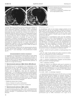 32-520-A-10 Syndrome pleural Radiodiagnostic 
*A *B 
viscérale. Beaucoup de théories ont été avancées pour expliquer la 
survenue de la pathologie pleurale liée à l’amiante. Aucune ne 
donne entièrement satisfaction. L’hypothèse la plus vraisemblable 
est la suivante : les fibres d’amiante seraient la cause directe de la 
pathologie pleurale constatée par irritation de la plèvre. La 
distribution basale des lésions serait due à la morphologie des fibres 
et à des anomalies du drainage lymphatique. La mise en évidence 
de plaques pleurales chez un malade attire l’attention sur 
d’éventuelles expositions à l’amiante. Il s’agit de témoins 
d’exposition. La présence de plaques pleurales n’a pas de valeur 
prédictive pour la survenue d’un mésothéliome. Néanmoins, comme 
elles attestent d’une exposition à l’amiante, il existe, chez les malades 
présentant des plaques pleurales, un risque indiscutable de 
mésothéliome, supérieur à celui de la population générale. Il est 
inutile de surveiller, soit en échographie, soit en TDM, soit même en 
IRM, les plaques pleurales détectées. 
Les fibromes pleuraux réalisent aussi des épaississements pleuraux 
localisés, mais de forme tumorale, et souvent localisés au niveau 
des scissures [56]. Leur sémiologie a été précédemment étudiée 
(fig 19). 
ÉPAISSISSEMENTS DIFFUS PLEURAUX 
La constatation d’un épaississement pleural diffus est assez banale 
en TDM thoracique. Néanmoins, il est absolument nécessaire de 
distinguer les épaississements bénins des épaississements malins. La 
clinique est dans ce cas d’un apport assez intéressant puisque, dans 
le cadre des mésothéliomes ou des adénocarcinomes pleuraux, la 
douleur est un signe très évocateur. 
¦ Épaississements pleuraux diffus bénins (fibrothorax) 
Le fibrothorax est la conséquence de l’organisation d’un 
épanchement pleural. Un épanchement pleural tuberculeux est le 
plus souvent en cause (fig 9, 10), cependant un hémothorax, un 
pyothorax ou une pleurésie liée à l’amiante peuvent eux aussi 
évoluer vers le fibrothorax, ainsi que les séquelles de 
radiothérapie [37]. La TDM objective parfaitement les épaississements 
pleuraux qui, dans le cas de bénignité, sont le plus souvent réguliers, 
stables dans le temps, souvent calcifiés. Il existe très souvent une 
hypertrophie de la graisse extrapleurale au contact de ces 
épaississements, traduisant un processus ancien. La TDM permet 
aussi d’étudier le parenchyme pulmonaire adjacent. Certains 
arguments sont en faveur de la bénignité : 
– stabilité des lésions dans le temps ; 
– absence d’atteinte de la plèvre médiastinale ; 
– augmentation d’épaisseur de la graisse extrapleurale. 
¦ Épaississements pleuraux diffus malins 
Les épaississements pleuraux diffus malins sont fréquemment 
associés à un épanchement pleural. Ils sont caractérisés par deux 
grandes étiologies : le mésothéliome malin et les métastases 
pleurales. 
18 Récidive néoplasique dans une poche de pneumonectomie 
(imagerie par résonance magnétique). 
A. Pondération T1 en écho de spin. 
B. Après injection de gadolinium, les nodulations tumo-rales 
sont hypersignalantes (flèche). 
Mésothéliome malin [7, 13, 14, 24, 30] 
Le mésothéliome malin est une tumeur maligne primitive de la 
plèvre. Dans 80 % des cas, une exposition à l’amiante est retrouvée. 
Cette tumeur est plus fréquente chez l’homme que chez la femme. 
Elle se manifeste habituellement après 50 ans et, pour ce qui 
concerne les sujets exposés à l’amiante, après un temps de latence 
de 20 à 40 ans (fig 20). 
Histologiquement, le mésothéliome malin peut être épithélial, 
mésenchymateux ou mixte. Microscopiquement, il est souvent 
difficile de distinguer une forme épithéliale ou mixte d’une 
métastase, d’un adénocarcinome, et une forme mésenchymateuse 
d’un fibrothorax. L’évolution spontanée des mésothéliomes est 
mauvaise, même sous traitement. Le pronostic dépend du type 
histologique : les formes épithéliales ou mixtes ont un pronostic 
moins mauvais que les formes fibroblastiques ou 
mésenchymateuses. Ce sont les constatations thoracoscopiques qui 
ont permis de classer le mésothéliome en différents stades [20] : 
– stade 1A : atteinte de la plèvre pariétale ou diaphragmatique d’un 
seul côté ; 
– stade 1B : stade 1A plus atteinte de la plèvre viscérale du même 
côté, sans envahissement de la plèvre médiastinale ; 
– stade 2A : atteinte homolatérale de la paroi et/ou du médiastin ; 
– stade 2B : atteinte controlatérale de la paroi et/ou du médiastin ; 
– stade 3 : extension extrathoracique, ganglions sus-claviculaires, 
atteinte péritonéale transdiaphragmatique ; 
– stade 4 : métastases à distance. 
Il ressort de l’étude de ces différents stades que le pronostic du 
mésothéliome repose sur l’atteinte de la plèvre viscérale et sur 
l’atteinte du médiastin. La TDM et l’IRM contribuent largement au 
bilan initial des mésothéliomes et au suivi thérapeutique, mais la 
sémiologie initiale à rechercher en dépistage sur la radiographie 
thoracique reste à décrire. 
À un stade « établi », la sémiologie comprend : 
– un épaississement pleural dans environ 90 à 95 % des cas ; il s’agit 
d’un épaississement pleural irrégulier ou nodulaire, tissulaire, se 
rehaussant après injection de produit de contraste, d’importance 
variable pouvant aller d’une petite masse tissulaire localisée à un 
épaississement pleural majeur circonférentiel atteignant la totalité 
de la cavité pleurale périphérique, mais aussi interscissural avec 
rétraction thoracique et attraction médiastinale ; cet aspect est très 
caractéristique du mésothéliome malin ; dans ce cas, la TDM et 
l’IRM permettent d’effectuer un bilan d’extension lorsque se pose le 
problème d’une chirurgie de décortication ; ainsi la TDM et l’IRM 
permettent de juger de l’envahissement extrapleural du 
mésothéliome qui se traduit par un obscurcissement de la graisse 
médiastinale et un envahissement des parties molles et des 
composantes osseuses de la paroi thoracique ; dans ce bilan 
extrapleural, pariétal mais aussi médiastinal, l’IRM semble plus 
performante que la TDM, notamment vers l’apex et en 
16 
 