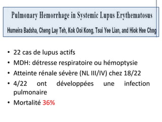 • 22 cas de lupus actifs
• MDH: détresse respiratoire ou hémoptysie
• Atteinte rénale sévère (NL III/IV) chez 18/22
• 4/22 ont développées une infection
pulmonaire
• Mortalité 36%
 