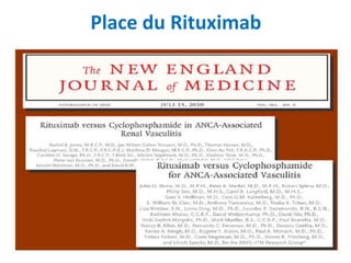 Place du Rituximab
 