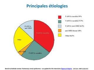 Principales étiologies
Bench-to-bedside review: Pulmonary–renal syndromes – an update for the intensivist /Spyros A Papiris Crit Care. 2007;11(3):213
 