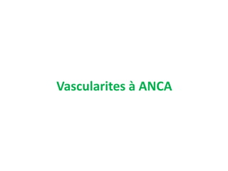 Vascularites à ANCA
 