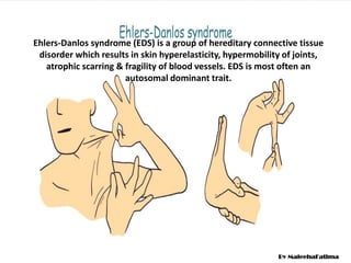 Ehlers-Danlos syndrome (EDS) is a group of hereditary connective tissue
disorder which results in skin hyperelasticity, hypermobility of joints,
atrophic scarring & fragility of blood vessels. EDS is most often an
autosomal dominant trait.
By MaleehaFatima
 