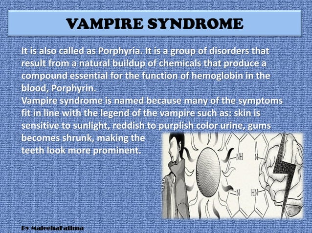SYNDROMES | PPT - Symptoms Of Vivrophe