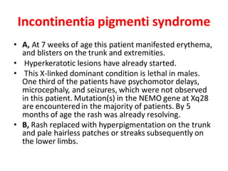 Syndromes mrcpch akp tas fop exam uk.pdf