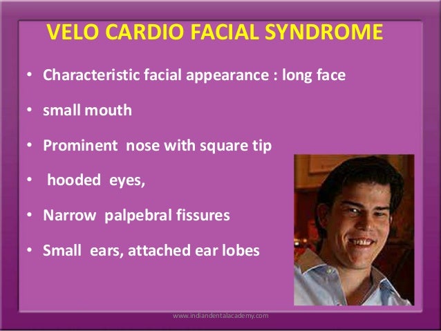 New porn 2020 - Velo myocardial facial disorder Girl strips masturbates on webcam