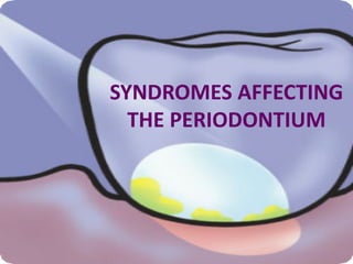 SYNDROMES AFFECTING
THE PERIODONTIUM
 