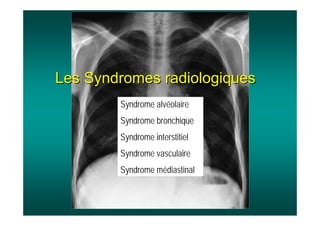 Les Syndromes radiologiques
Les Syndromes radiologiques
Syndrome alvéolaire
Syndrome bronchique
Syndrome interstitiel
Syndrome vasculaire
Syndrome médiastinal
 