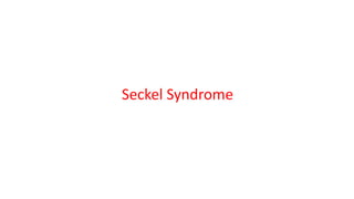 Secke Syndrome with significant dental involvement | PPTX