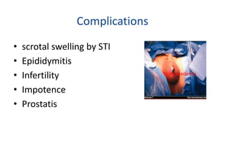 Complications
• scrotal swelling by STI
• Epididymitis
• Infertility
• Impotence
• Prostatis
Scrotal edema
 
