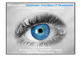 Synergie tussen microscopie & Cone Beam CT voor minimaal invasieve cariesbestrijding met composiet - Prof. Dr. P. Lambrechts