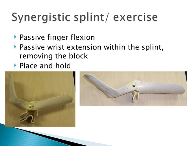 synergist splint for flexor tendon repair | PPT
