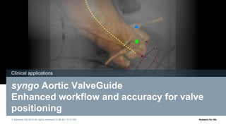 © Siemens AG 2013 All rights reserved. H IM AX 11/12-193 Answers for life.
syngo Aortic ValveGuide
Enhanced workflow and accuracy for valve
positioning
Clinical applications
 