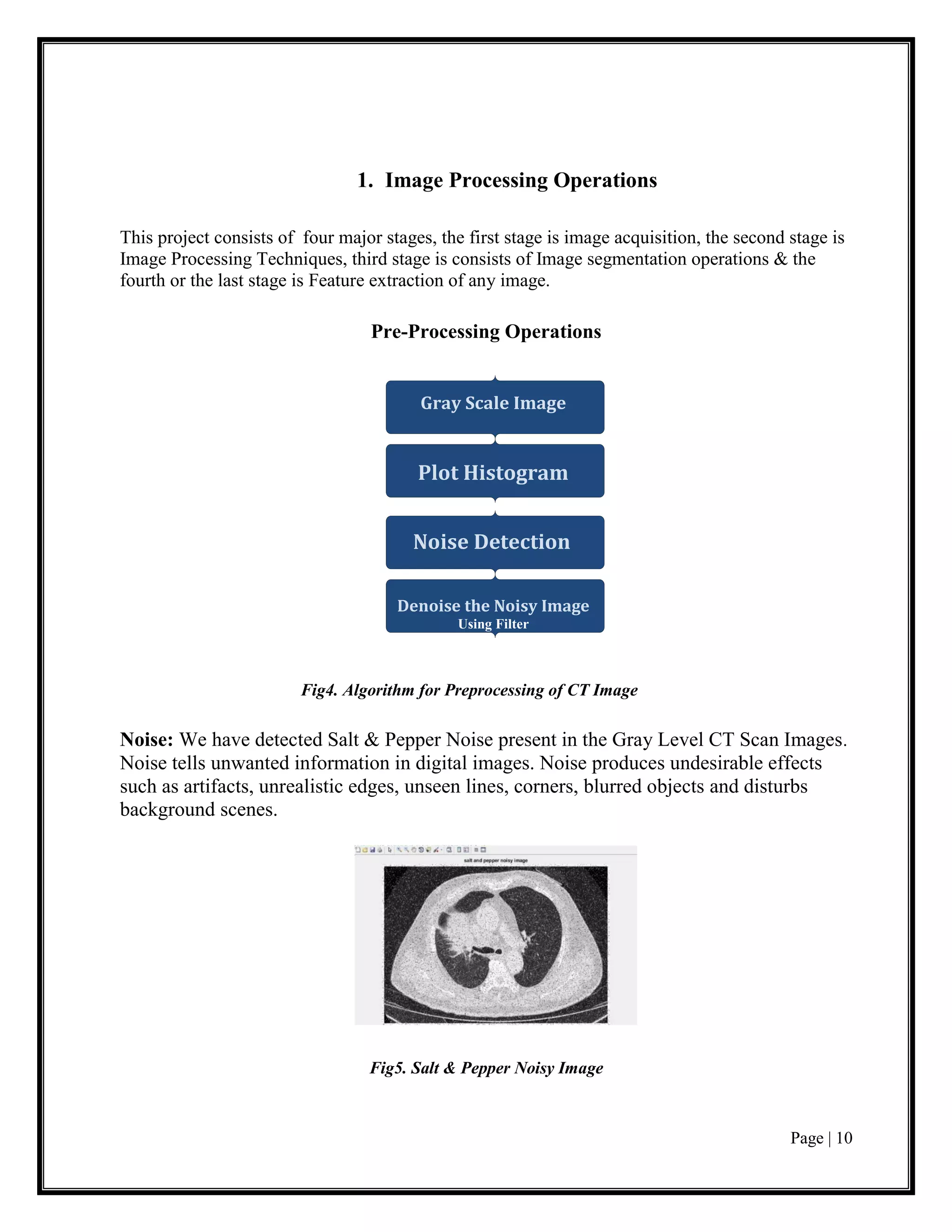 Page | 10
1. Image Processing Operations
This project consists of four major stages, the first stage is image acquisition, the second stage is
Image Processing Techniques, third stage is consists of Image segmentation operations & the
fourth or the last stage is Feature extraction of any image.
Pre-Processing Operations
Fig4. Algorithm for Preprocessing of CT Image
Noise: We have detected Salt & Pepper Noise present in the Gray Level CT Scan Images.
Noise tells unwanted information in digital images. Noise produces undesirable effects
such as artifacts, unrealistic edges, unseen lines, corners, blurred objects and disturbs
background scenes.
Fig5. Salt & Pepper Noisy Image
Plot Histogram
Noise Detection
Denoise the Noisy Image
Using Filter
Gray Scale Image
 