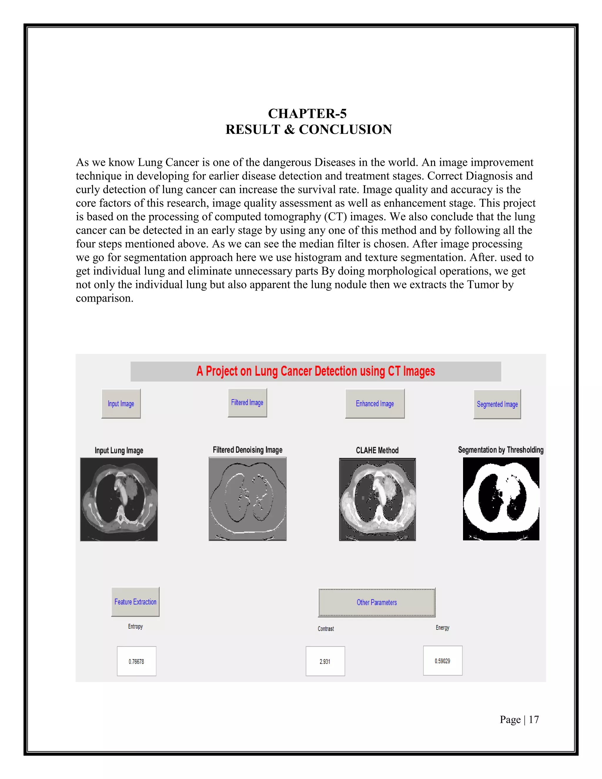 Page | 17
CHAPTER-5
RESULT & CONCLUSION
As we know Lung Cancer is one of the dangerous Diseases in the world. An image improvement
technique in developing for earlier disease detection and treatment stages. Correct Diagnosis and
curly detection of lung cancer can increase the survival rate. Image quality and accuracy is the
core factors of this research, image quality assessment as well as enhancement stage. This project
is based on the processing of computed tomography (CT) images. We also conclude that the lung
cancer can be detected in an early stage by using any one of this method and by following all the
four steps mentioned above. As we can see the median filter is chosen. After image processing
we go for segmentation approach here we use histogram and texture segmentation. After. used to
get individual lung and eliminate unnecessary parts By doing morphological operations, we get
not only the individual lung but also apparent the lung nodule then we extracts the Tumor by
comparison.
 