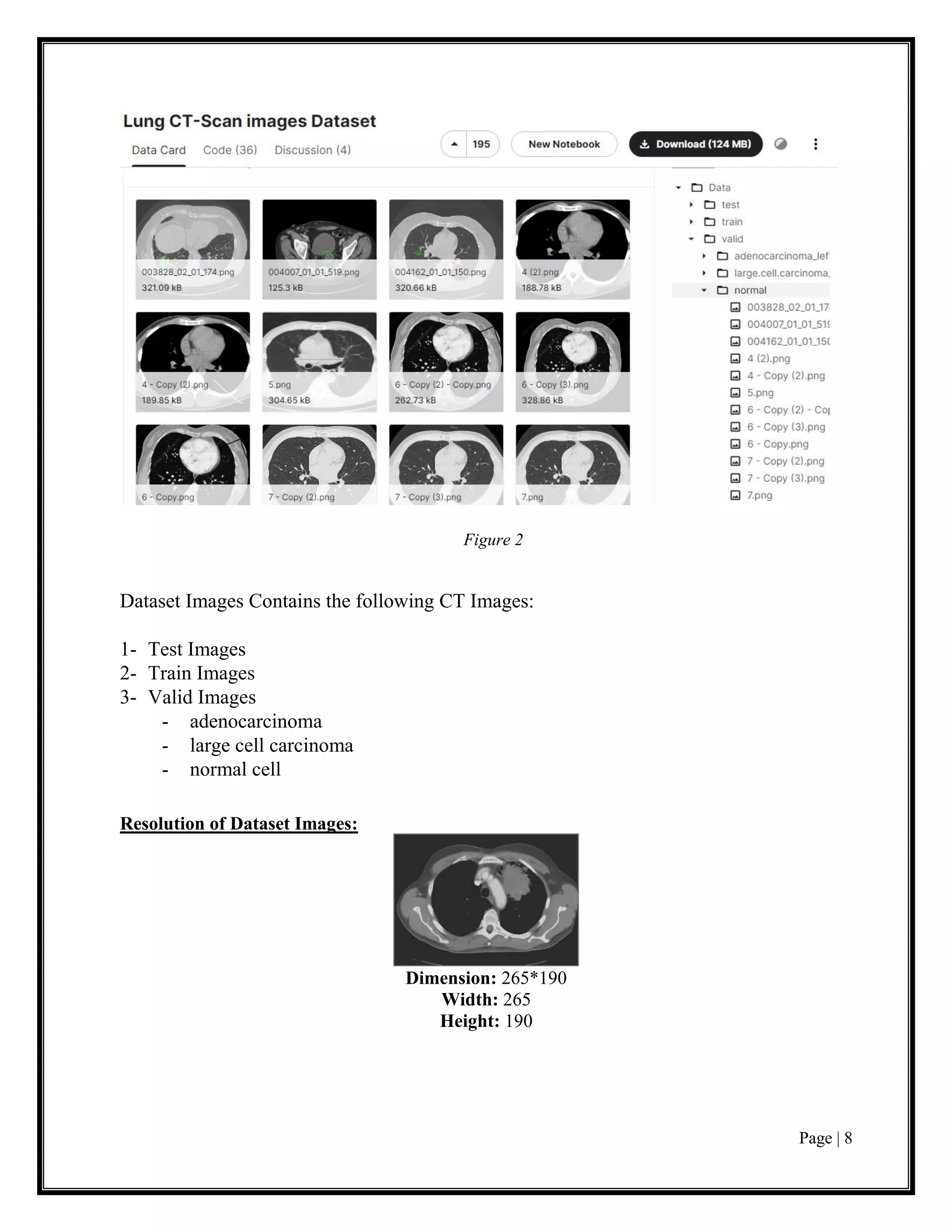 Page | 8
Figure 2
Dataset Images Contains the following CT Images:
1- Test Images
2- Train Images
3- Valid Images
- adenocarcinoma
- large cell carcinoma
- normal cell
Resolution of Dataset Images:
Dimension: 265*190
Width: 265
Height: 190
 