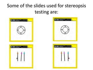 Some of the slides used for stereopsis
testing are:
 