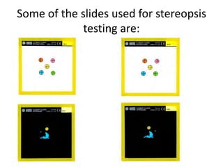 Some of the slides used for stereopsis
testing are:
 