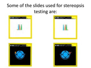 Some of the slides used for stereopsis
testing are:
 