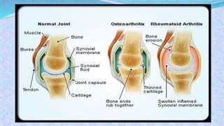 BIOCHEMISTRY OF SYNOVIAL FLUID | PPTX