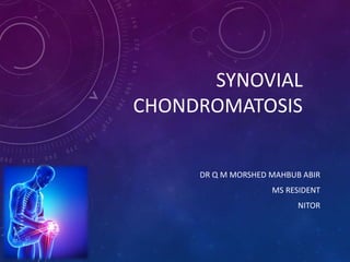 SYNOVIAL
CHONDROMATOSIS
DR Q M MORSHED MAHBUB ABIR
MS RESIDENT
NITOR
 