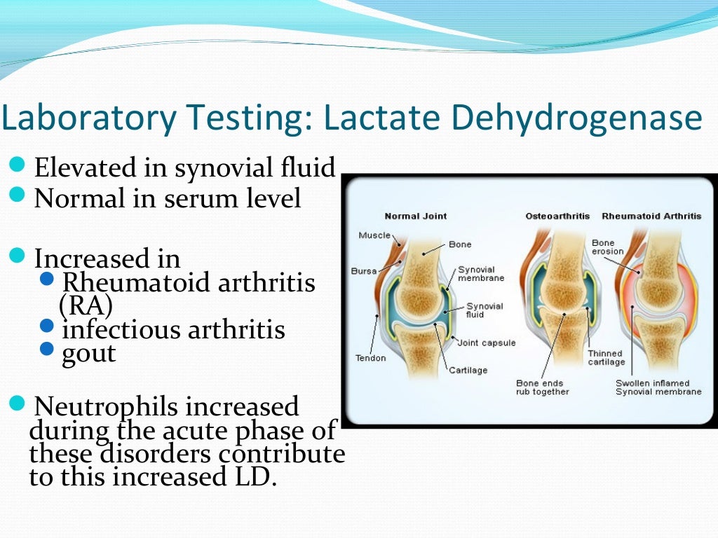 Synovial fluid