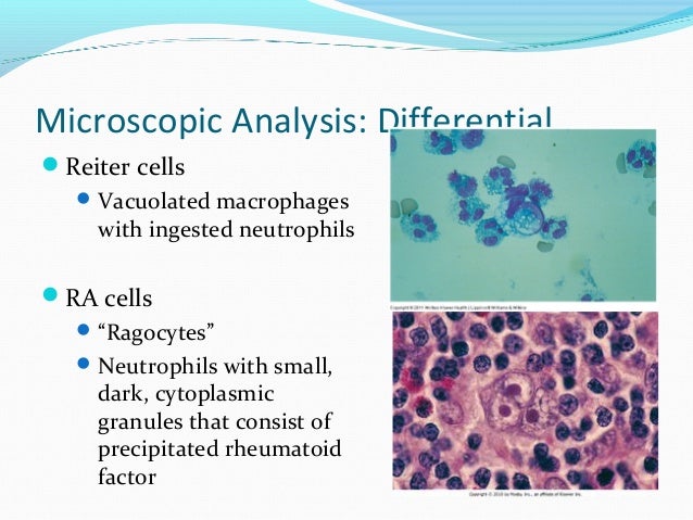 Synovial fluid