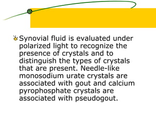 Synovial fluid is evaluated under polarized light to recognize the presence of crystals and to distinguish the types of crystals that are present. Needle-like monosodium urate crystals are associated with gout and calcium pyrophosphate crystals are associated with pseudogout.  