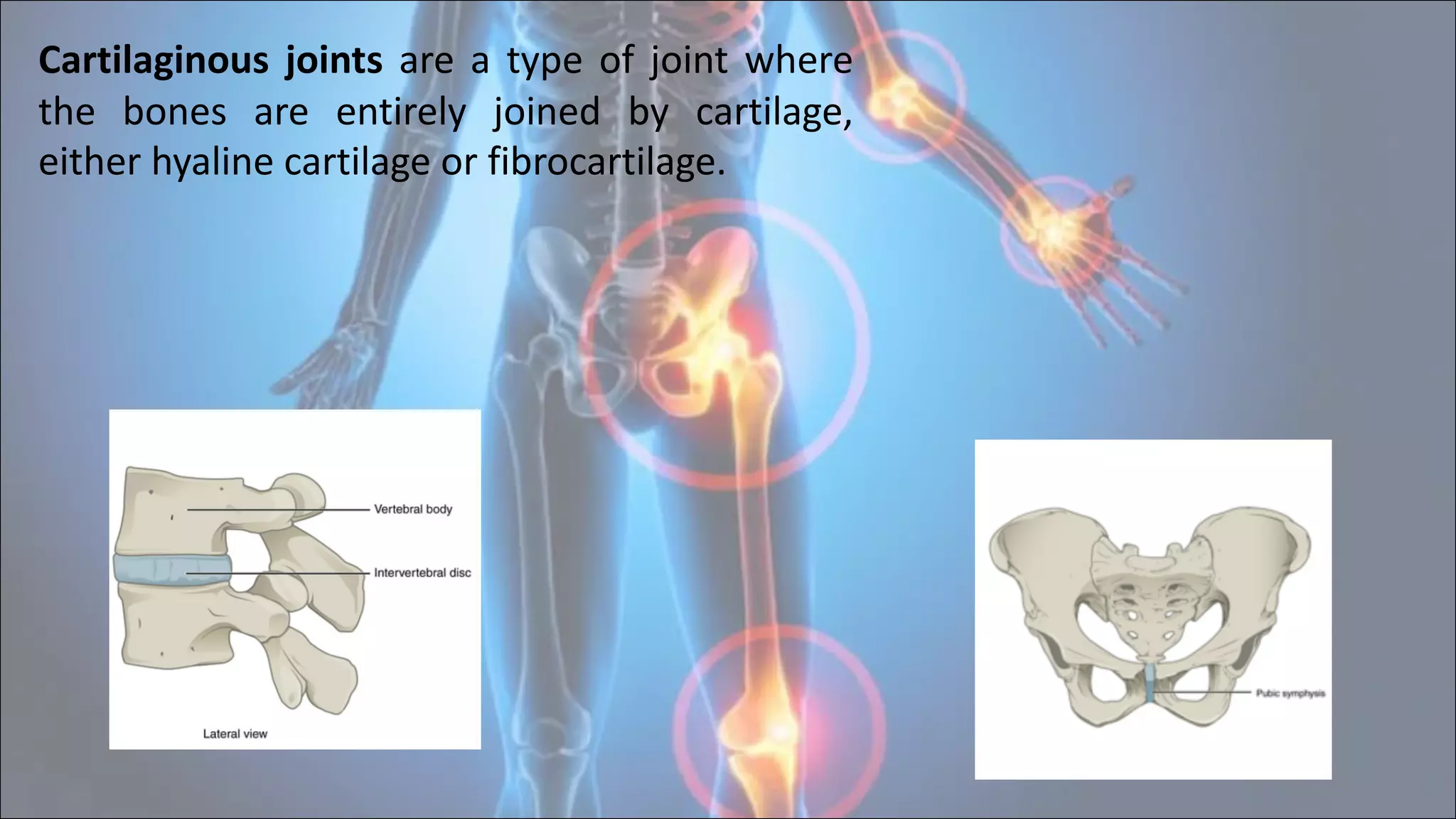 5
Cartilaginous joints are a type of joint where
the bones are entirely joined by cartilage,
either hyaline cartilage or fibrocartilage.
 