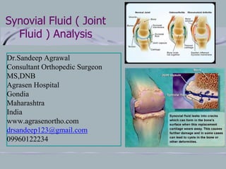Synovial Fluid ( Joint
Fluid ) Analysis
Dr.Sandeep Agrawal
Consultant Orthopedic Surgeon
MS,DNB
Agrasen Hospital
Gondia
Maharashtra
India
www.agrasenortho.com
drsandeep123@gmail.com
09960122234
 