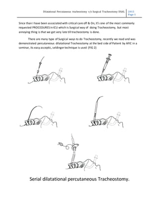 Dilatational Percutaneous tracheostomy v/s Surgical Tracheostomy DSAS. 2015
Page 1
Since than I have been associated with critical care off & On, It’s one of the most commonly
requested PROCEDURES in ICU which is Surgical way of doing Tracheostomy, but most
annoying thing is that we get very late till tracheostomy is done.
There are many type of Surgical ways to do Tracheostomy, recently we read and was
demonstrated percutaneous dilatational Tracheostomy at the bed side of Patient by AFIC in a
seminar, its easy asceptic, seldinger technique is used (FIG 2)
Serial dilatational percutaneous Tracheostomy.
 