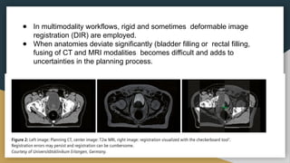 Synthetic ct -understanding the basics .pptx