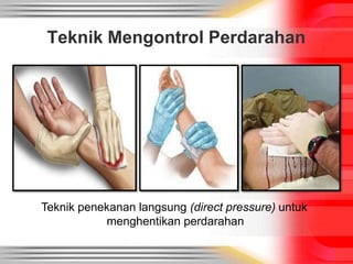 Teknik penekanan langsung (direct pressure) untuk
menghentikan perdarahan
Teknik Mengontrol Perdarahan
 